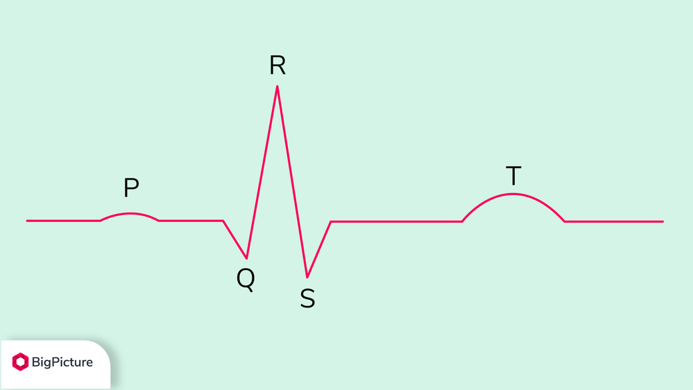 cadence-meaning-heart-cadence.png